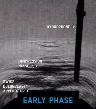 earlyphase DolorClast Early Phase