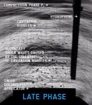 latephase DolorClast Late Phase